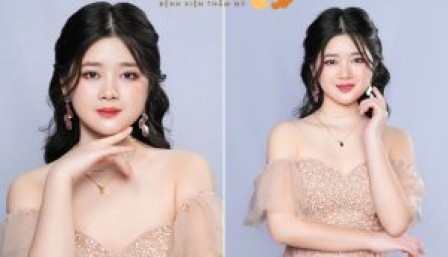 Cộng đồng mạng “vỡ oà” với màn lột xác ngoạn mục của cô gái mặt lõm