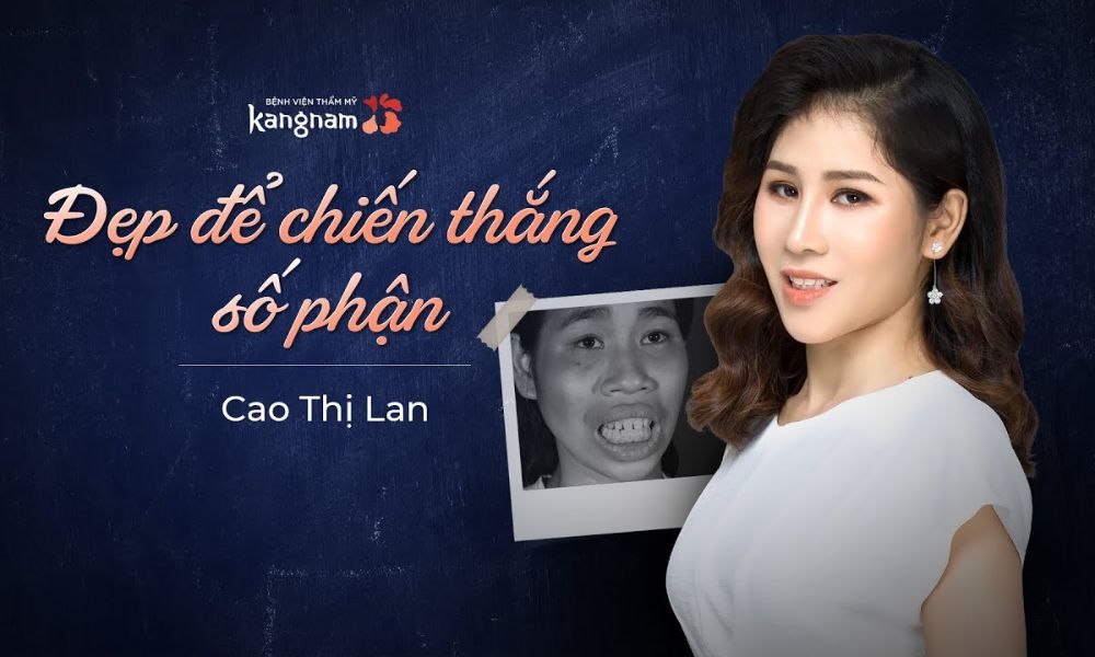Thí sinh Cao Thị Lan có cơ hội 'đổi đời' nhờ phẫu thuật thẩm mỹ và có cuộc sống hạnh phúc, may mắn hơn