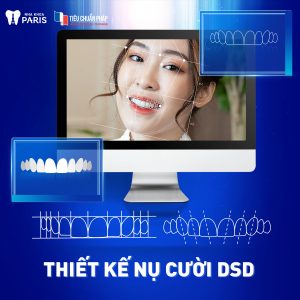 Nha khoa Paris luôn đi đầu trong việc cập nhật và ứng dụng công nghệ tiên tiến