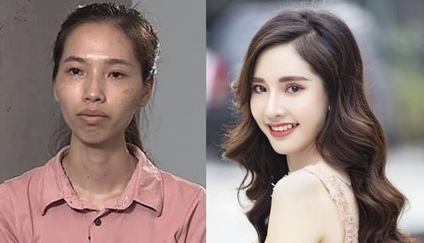 Cô gái Phan May hạnh phúc sau thẩm mỹ