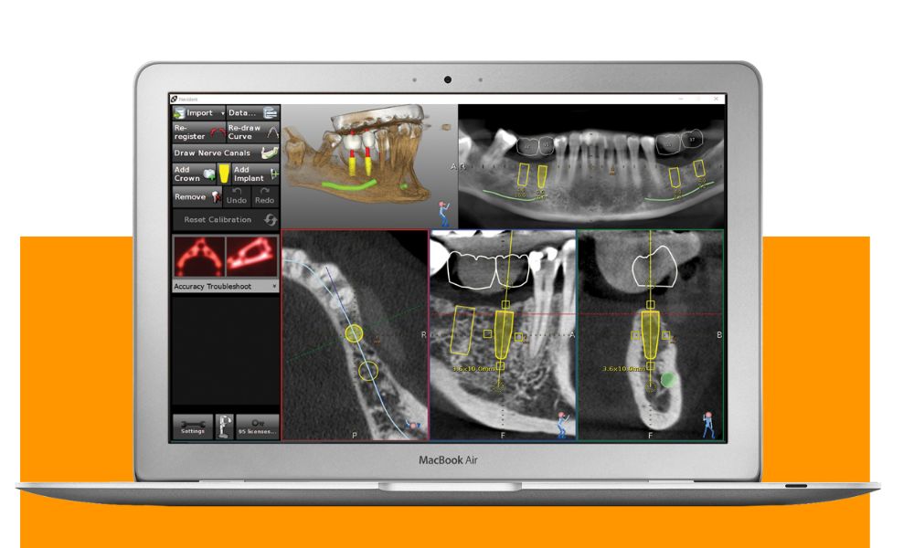 Việc áp dụng công nghệ định vị phẫu thuật Navident, SCI cam kết mang đến dịch vụ chất lượng và đáng tin cậy cho khách hàng
